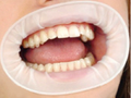 dentamedix-o-style-latex-cheek-retractor-60-box-white-medium-87x87mm-1
